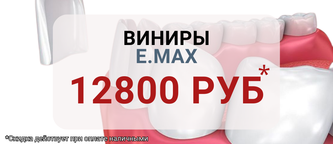 Винир E.max  <del>20 000</del>   -  12 800 рублей