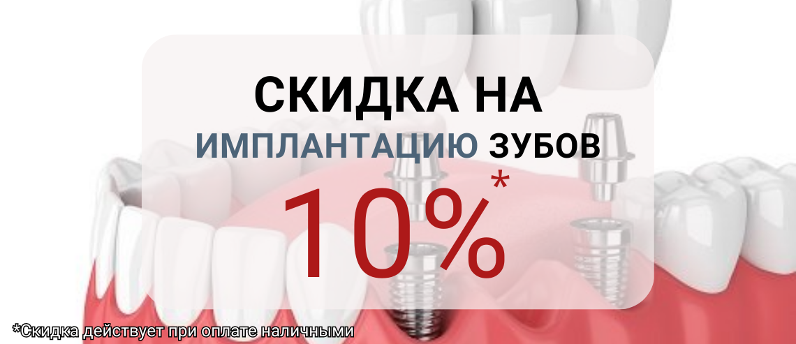 СКИДКА НА ИМПЛАНТАЦИЮ 10%
