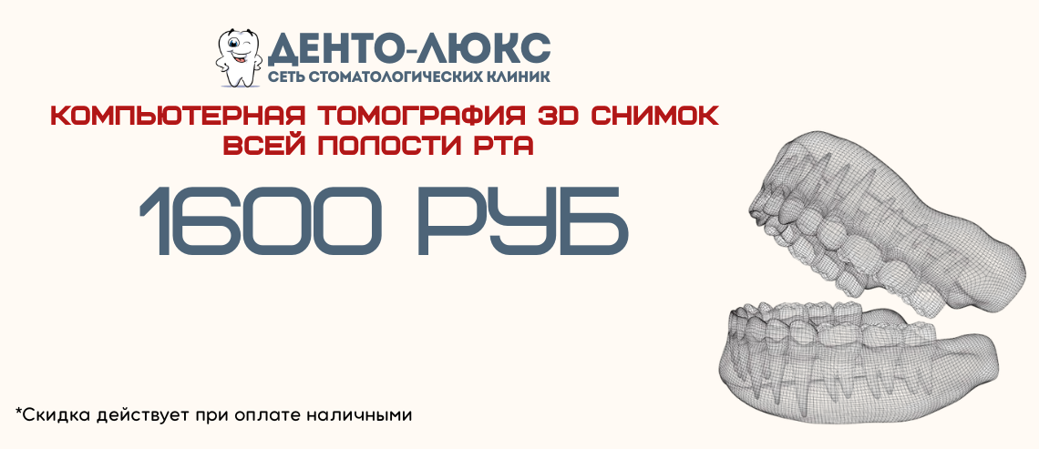 Компьютерная томография (КТ) 3D снимок всей полости рта <del>2500</del> 1600 рублей в Москве