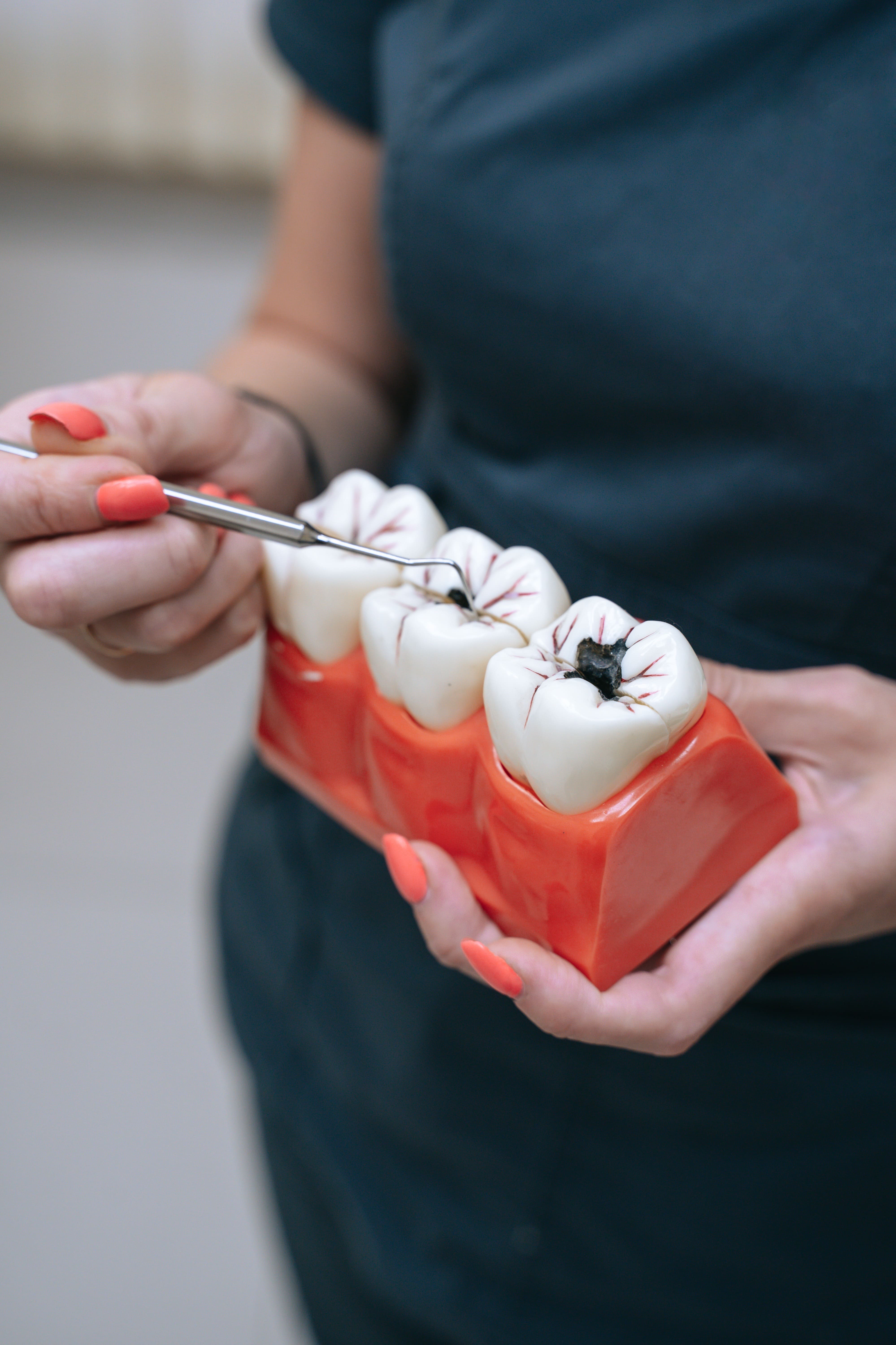 Кариес молочных зубов - виды, его причины и лечение